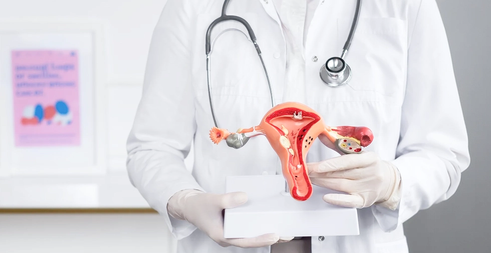 Arzt hält anatomisches Modell der Gebärmutter