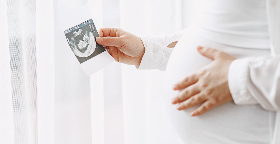 Schwangere Frau mit Ultraschallbild in der Hand